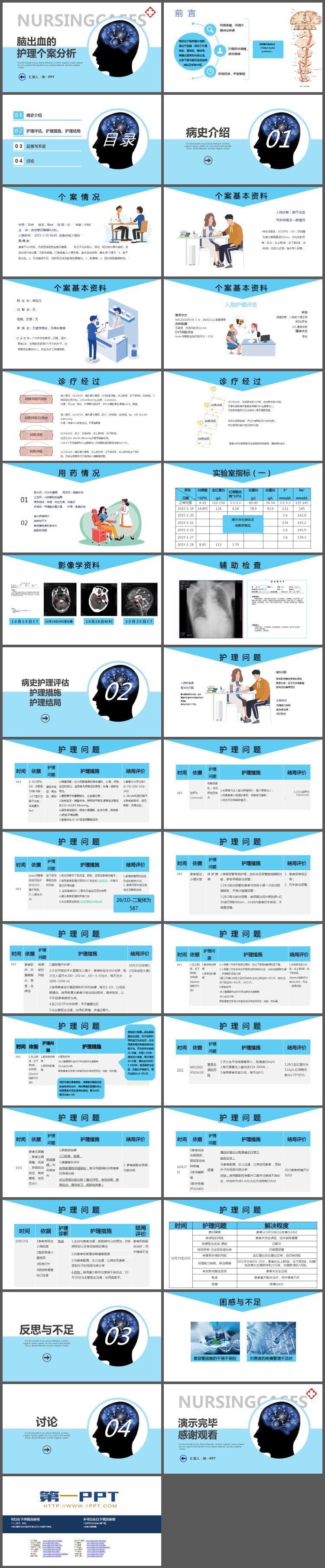 脑出血的护理案例分析PPT模板