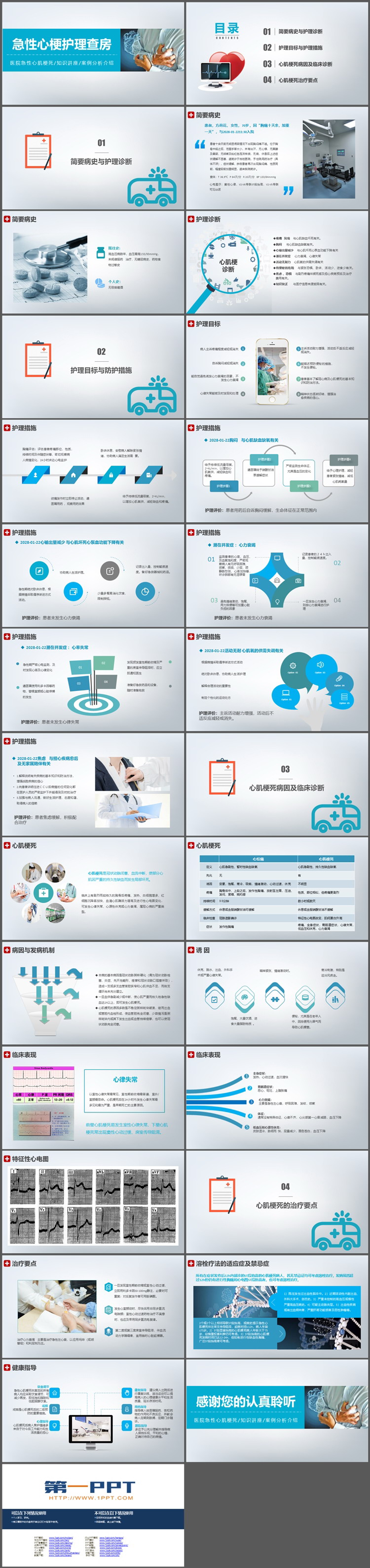 急性心梗医疗护理查房PPT模板下载
